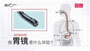 做胃镜是种什么体验?到底痛不痛?健康完整版视频在线观看爱奇艺