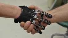 老外发明机械假肢，可完全替代手指，手能做到的事它都能做