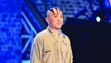 “三毛”扮演者，14岁谢顶植发缝300多针，重返舞台惨遭淘汰
