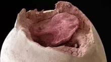 你从未见过的蘑菇头，显微镜将其放大1000倍，看完太吓人了！